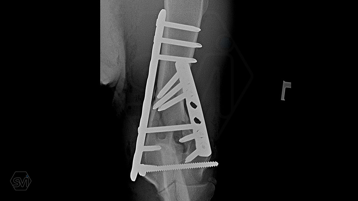 Nightmare for all of us: diastal humeral Y-fracture in a large active dog (German Shepherd)