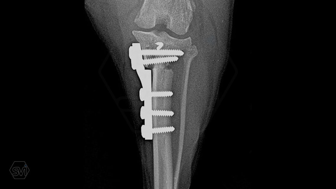 Introducing the TPLO-M „terraced” plate family from Smartvetimplants.com