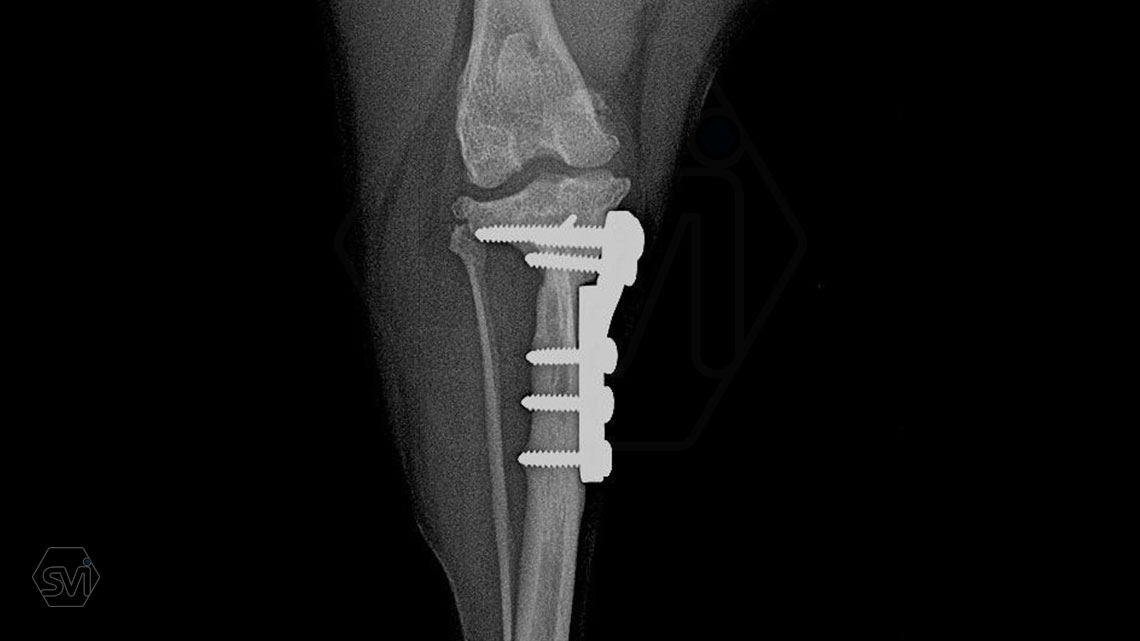 TPLO-M with one and a half year control