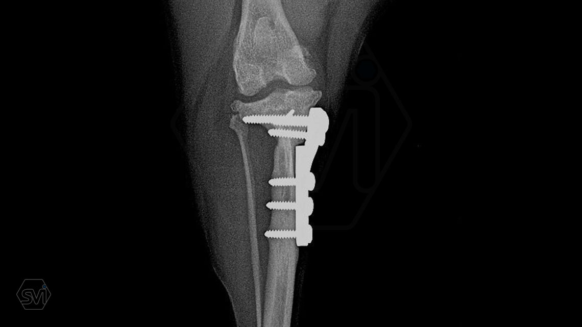 TPLO-M with one and a half year control