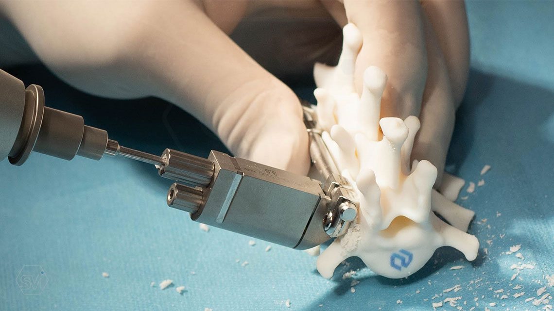 With the help of new clamp fixator and drill guide device, using the SOP-LC system is now “child’s play”