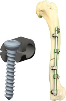 Contouring is easier, more stable, and more uniform. 360⁰ contouring around the central axis